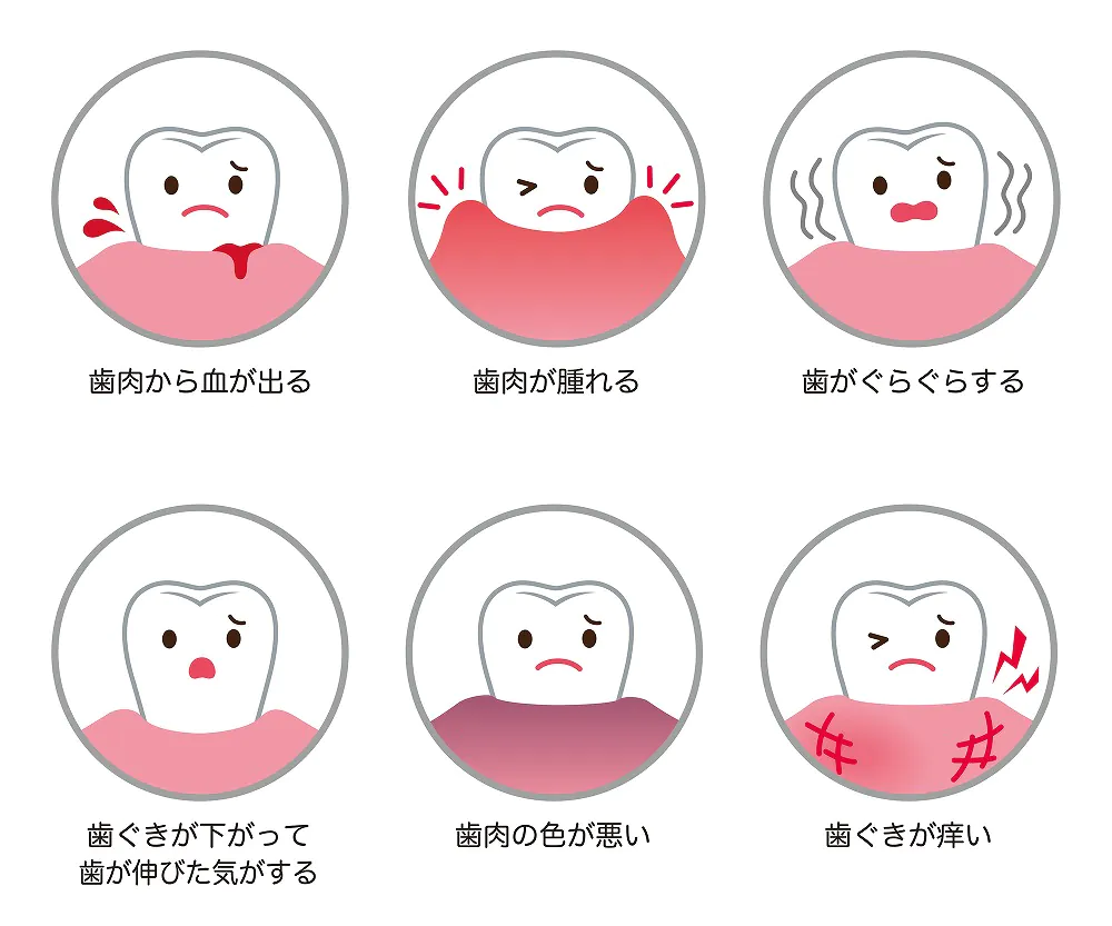 歯茎からの出血・歯茎の腫れを放置するのは危険です！